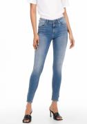 NU 25% KORTING: Only Ankle jeans ONLBLUSH MID SK ANK ZIP DNM